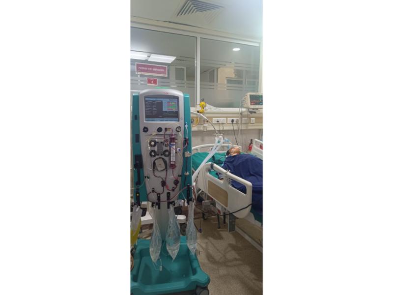 Ventilator Facility in PICU